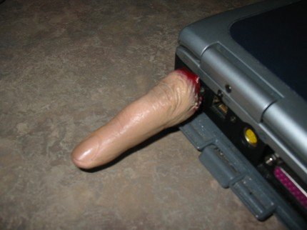 ��(g��)�Ԅ�(chu��ng)��Ѫ����ָU�P