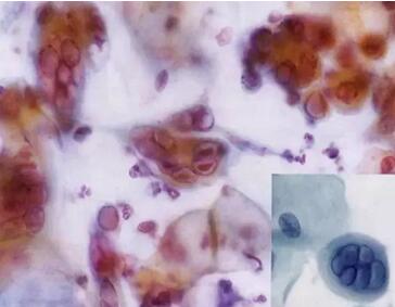 ���(l��i)ϴ���ӣ��������ךW���M(j��n)�ھ�ϴ�O(sh��)���ꑌ�������Ҽ�